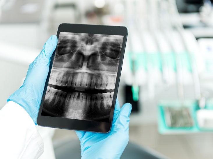 What Is The Most Common X-Ray Among All Radiological Procedures?