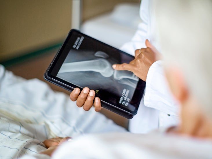Psoriatic Arthritis XRay Uses, Procedure, and Other Diagnostic Tests