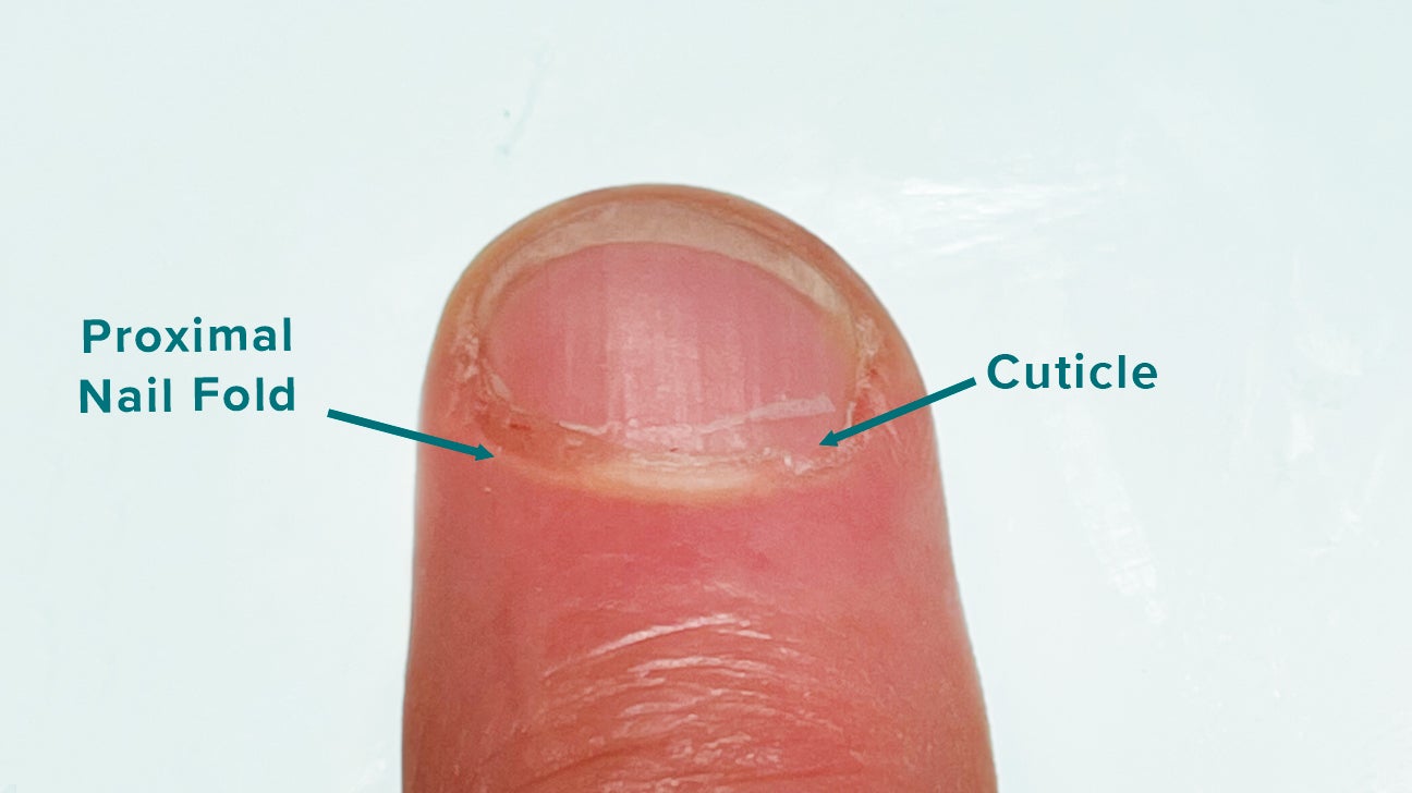 Proximal Nail Fold Pictures, Function, Care, and Medical Concerns