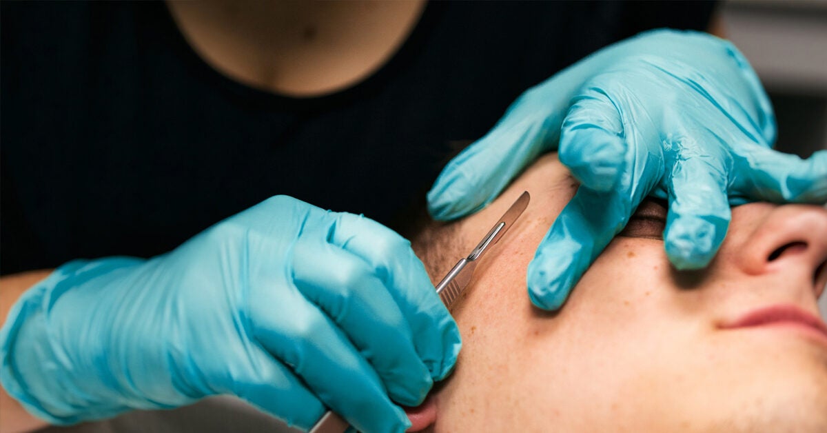 What's the Difference Between Microdermabrasion and Dermaplaning?