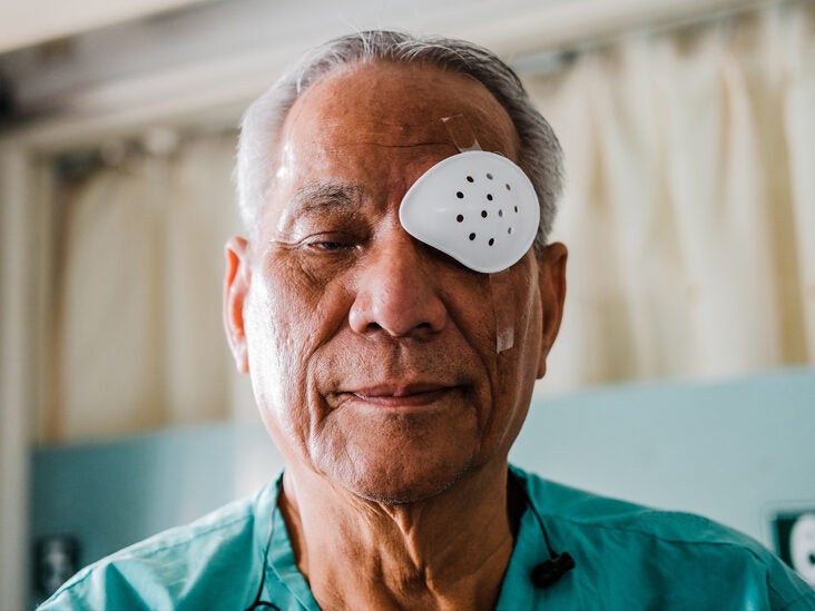 Why Are My Eyes Itchy After Cataract Surgery Infoupdate