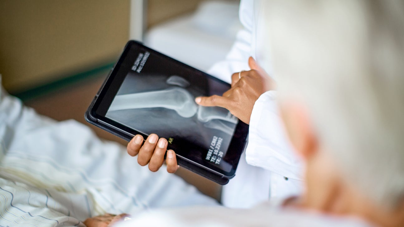 Psoriatic Arthritis X Ray Uses Procedure And Other Diagnostic Tests