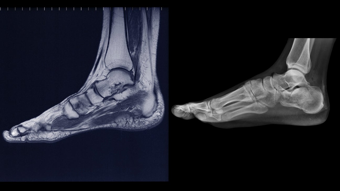 Urgent Care Foot X Ray Cost Tricheenlight