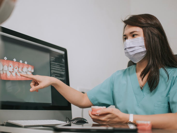 Cantilever Dental Bridge Benefits, Drawbacks, and How it Works