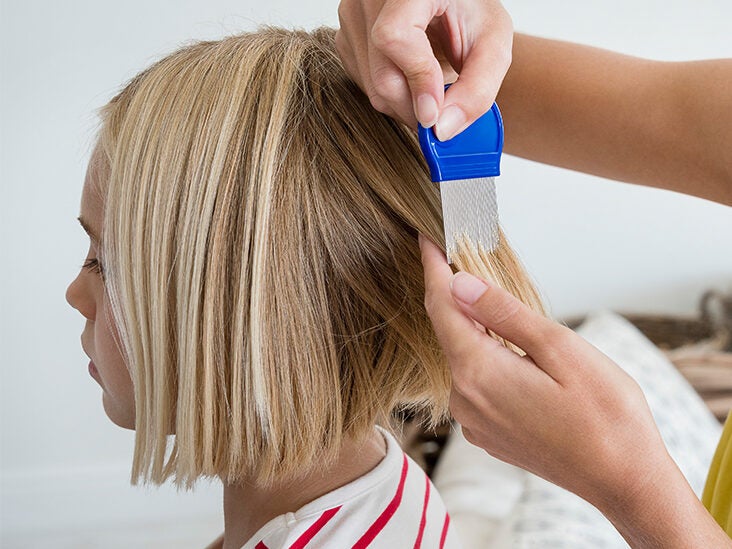 How to Catch Lice in Blonde Hair: Remedies and Treatment