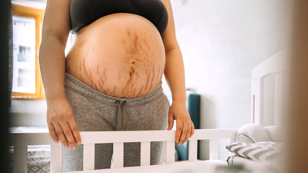Top Treatments for Tightening Post Pregnancy Belly