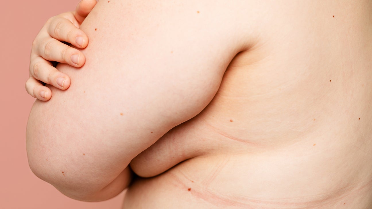 What Does a Hard Lump in the Breast Mean?