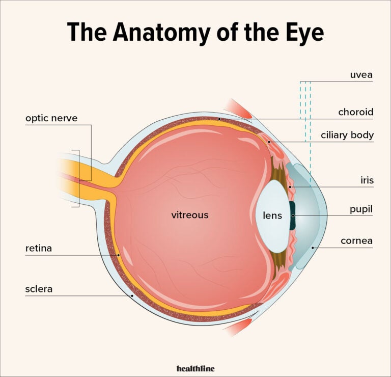 What To Know About Iritis Anterior Uveitis 