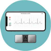 KardiaMobile EKG Monitor - Instant EKG on Your Phone