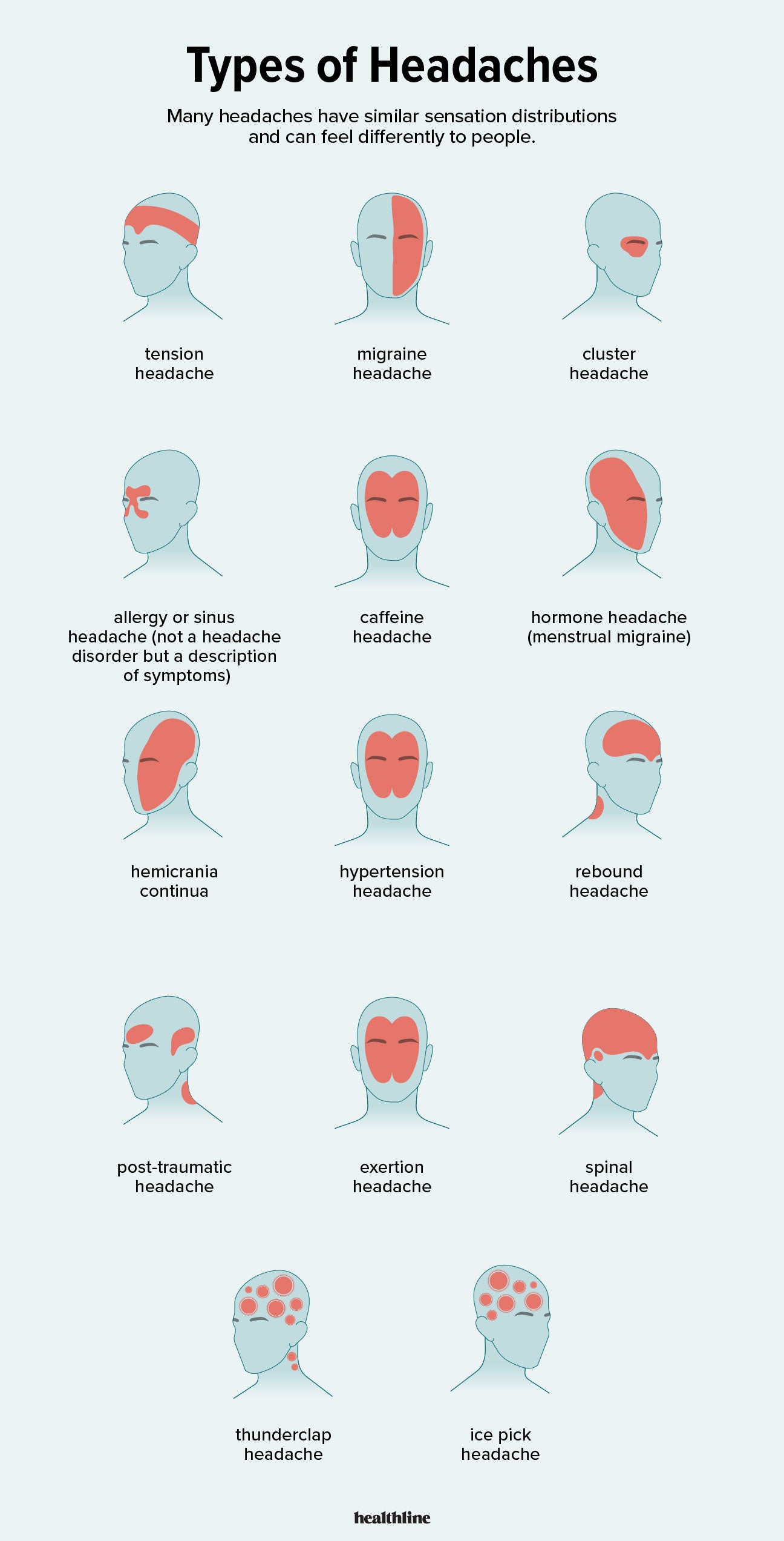 Headache on top of head: 11 common causes