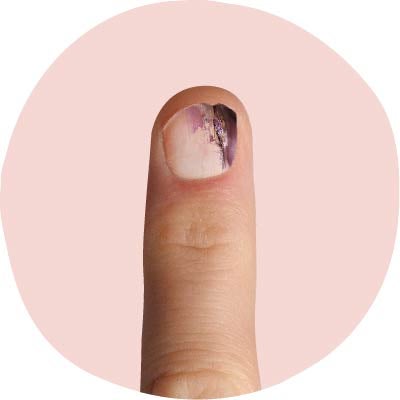 Fingernails: Do's and don'ts for healthy nails
