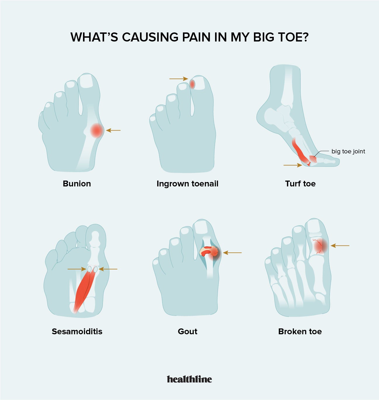 Stabbing Pain In Tip Of Big Toe