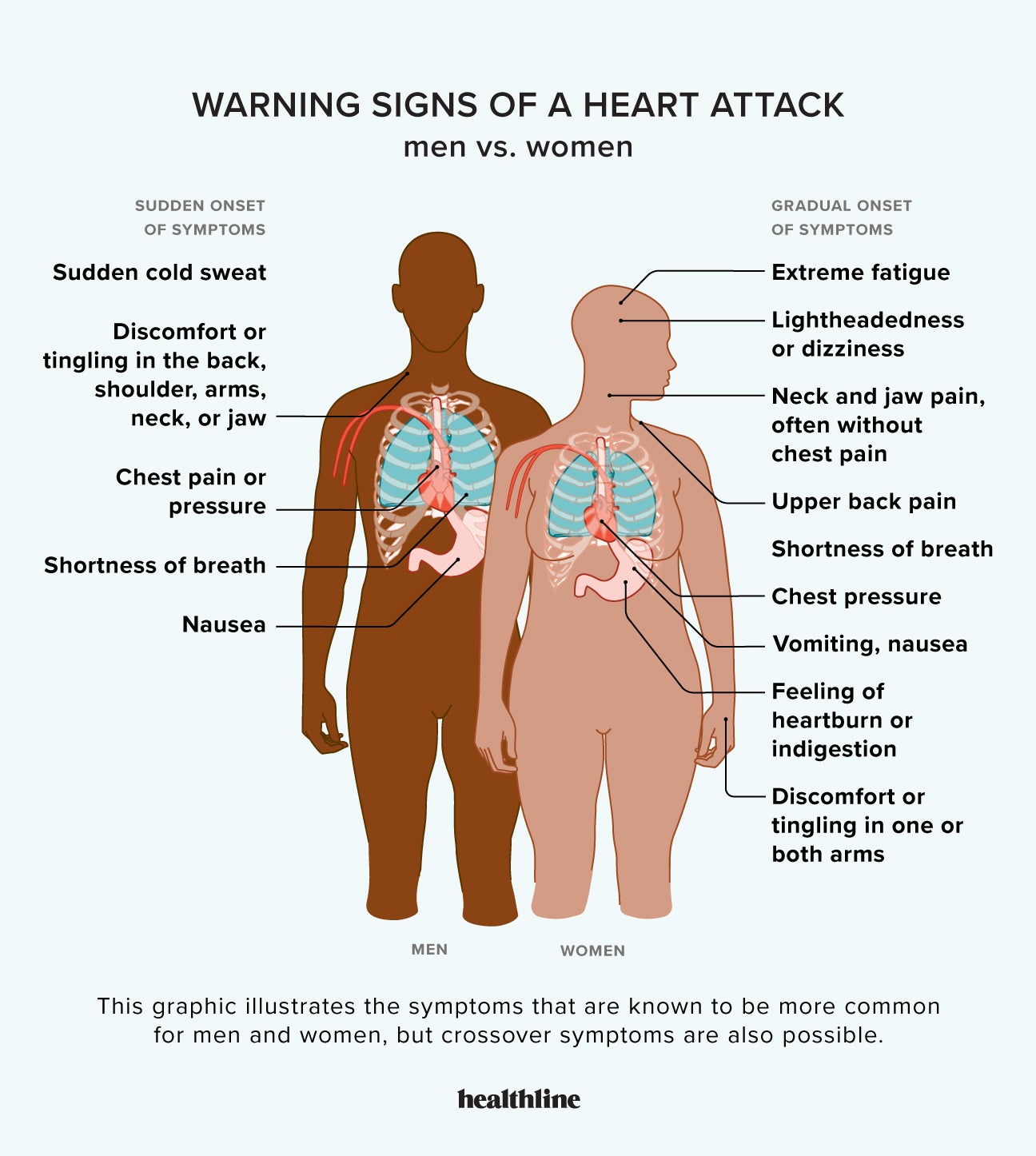 Heart Blockage: Explained with Pictures • MyHeart