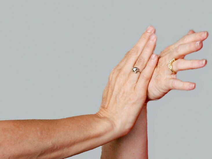 11 Hand Exercises to Ease Osteoarthritis Pain