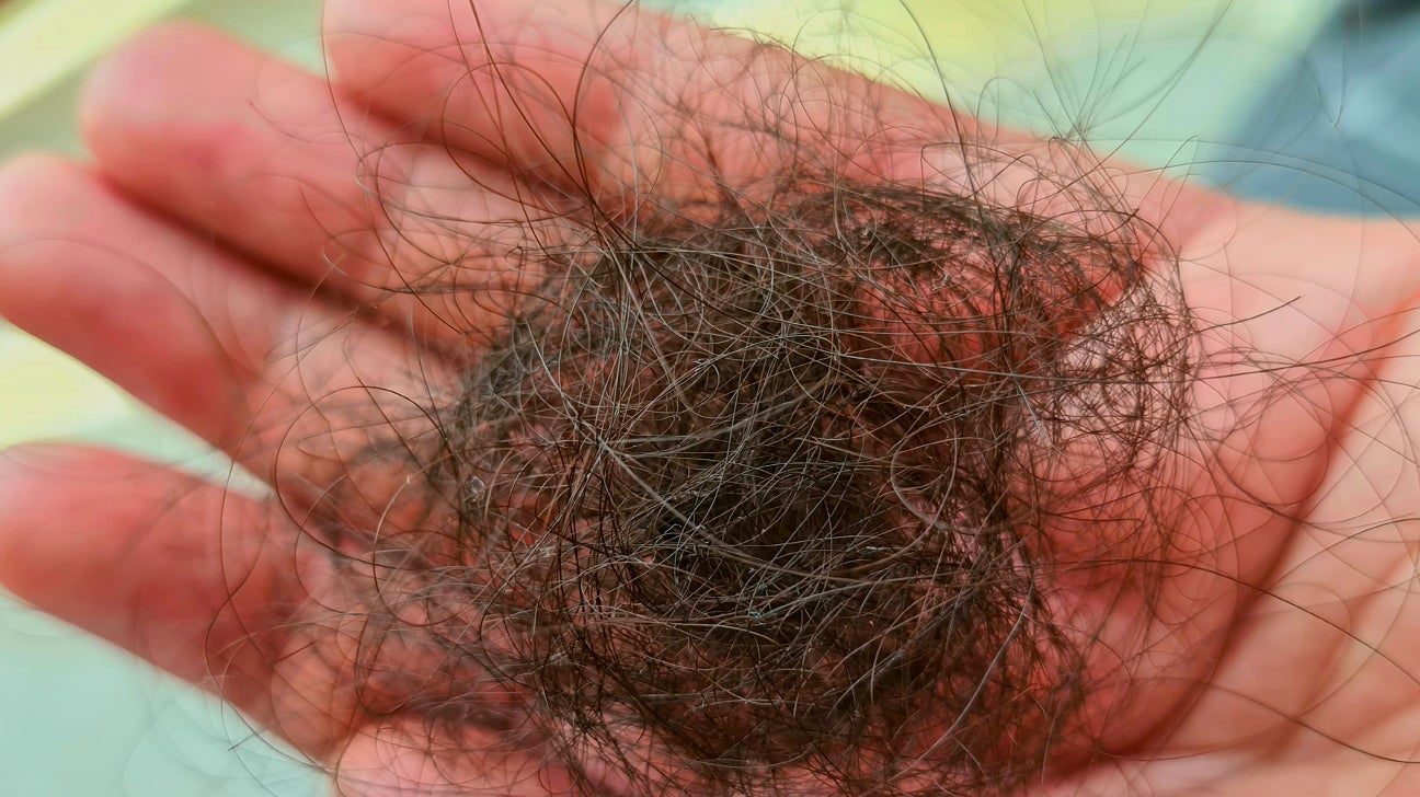 Aggregate More Than 153 Hair Fall Meaning In Tamil Latest Camera edu vn