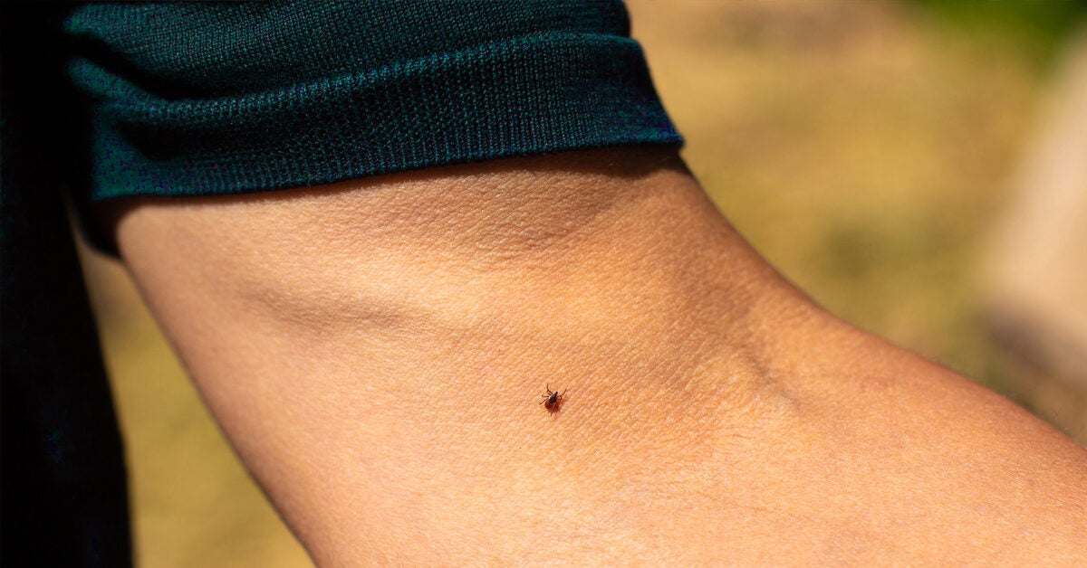 what happens when dog ticks bite humans