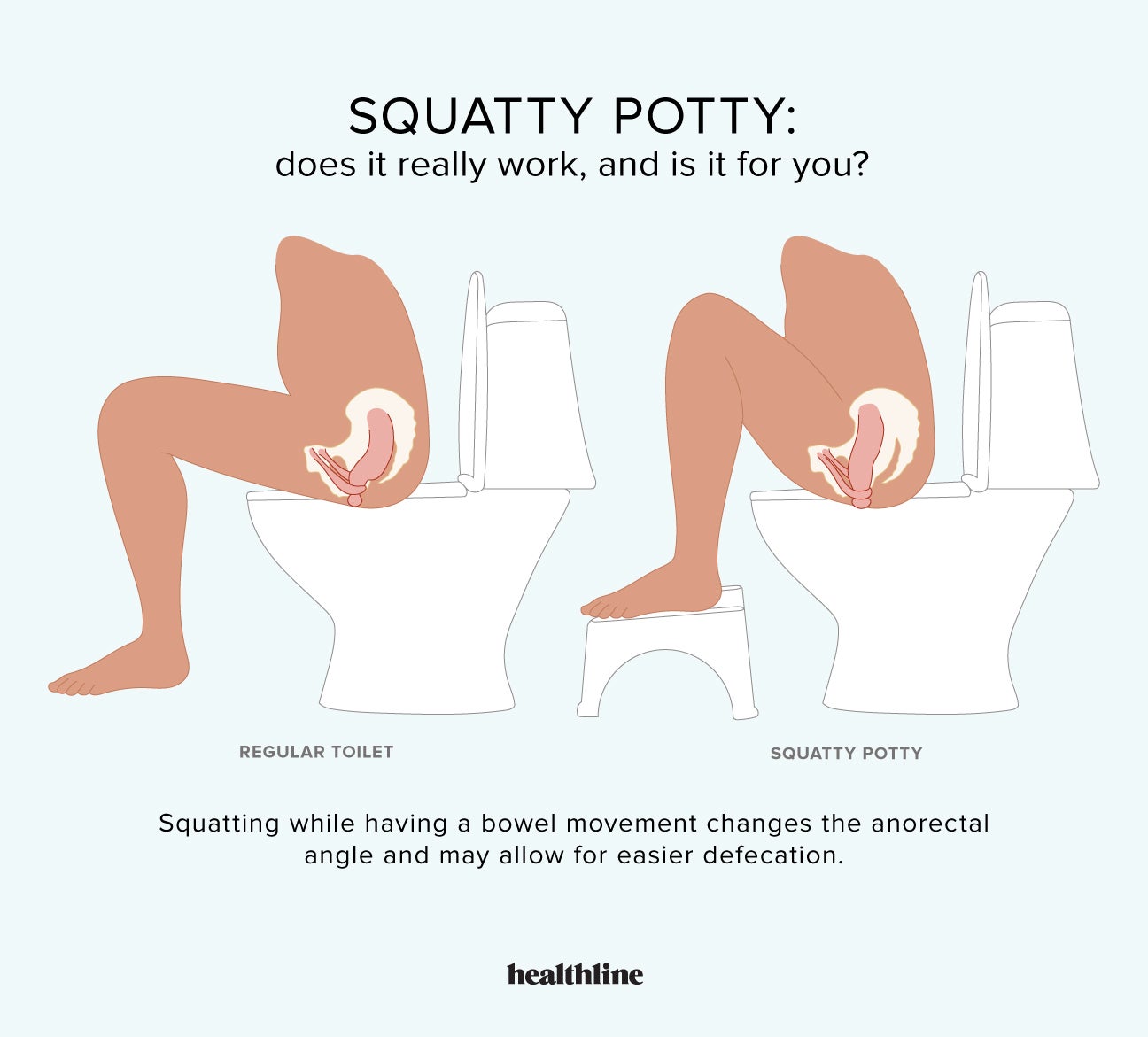 The Squatty Potty, A Toilet Step Stool Made For the 'Perfect Poop