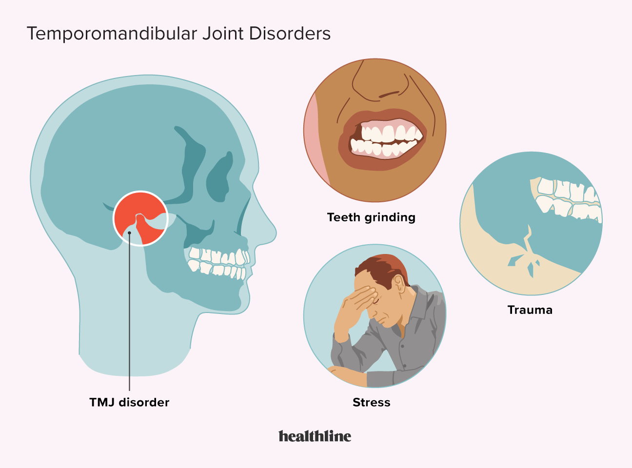 Jaw and Temporomandibular Joint: Anatomy