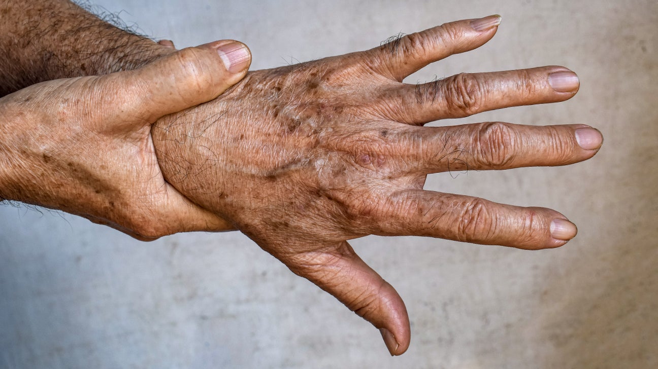 light-brown-spots-appearing-on-skin-overnight-americanwarmoms