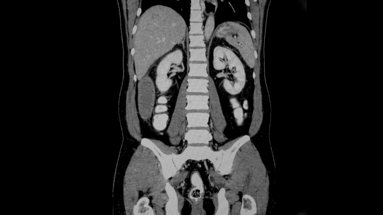Ct Scan Parts Of The Body At Emily Wolcott Blog