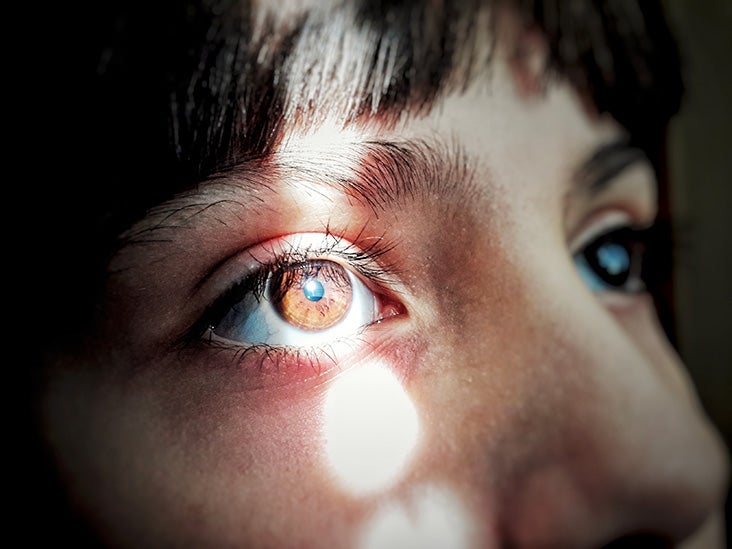 Eye Injections and Anxiety Tips to Manage