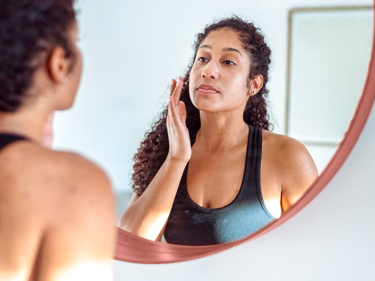732px x 549px - Adult Acne: Treatment, Causes, and More