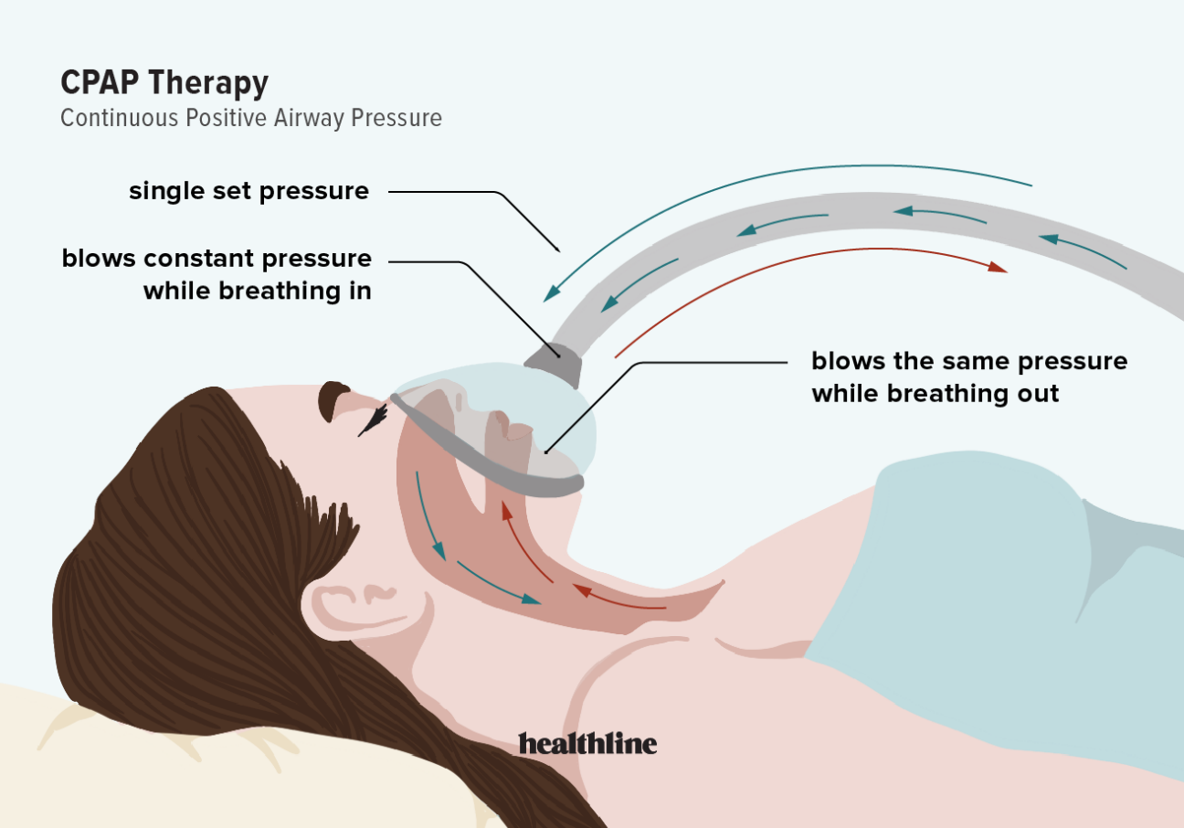 Will cpap therapy make your dick hard