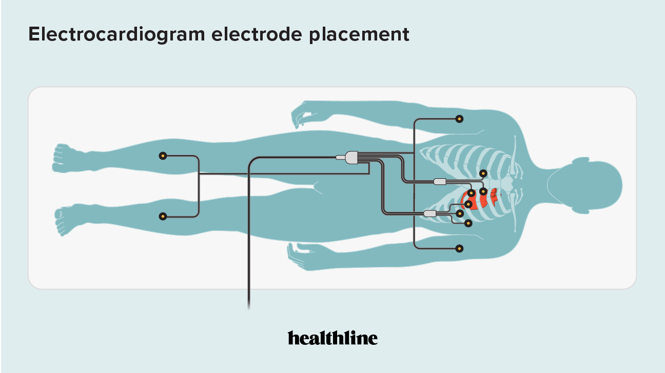 electrocardiogram-procedure-risks-results