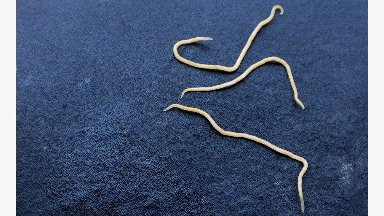 What Do Human Worms Look Like Infoupdate