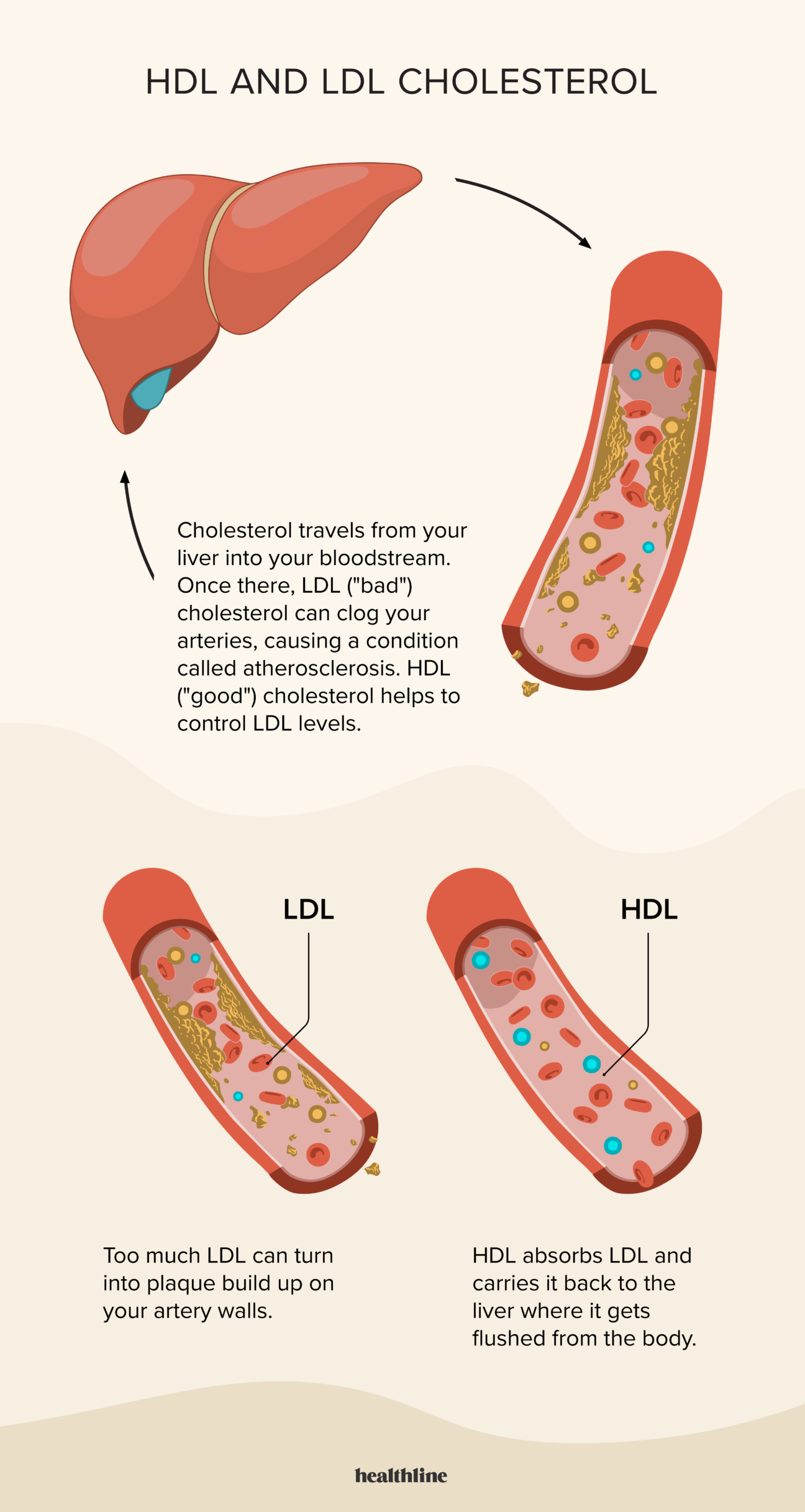 Why Does Your Body Need Cholesterol?