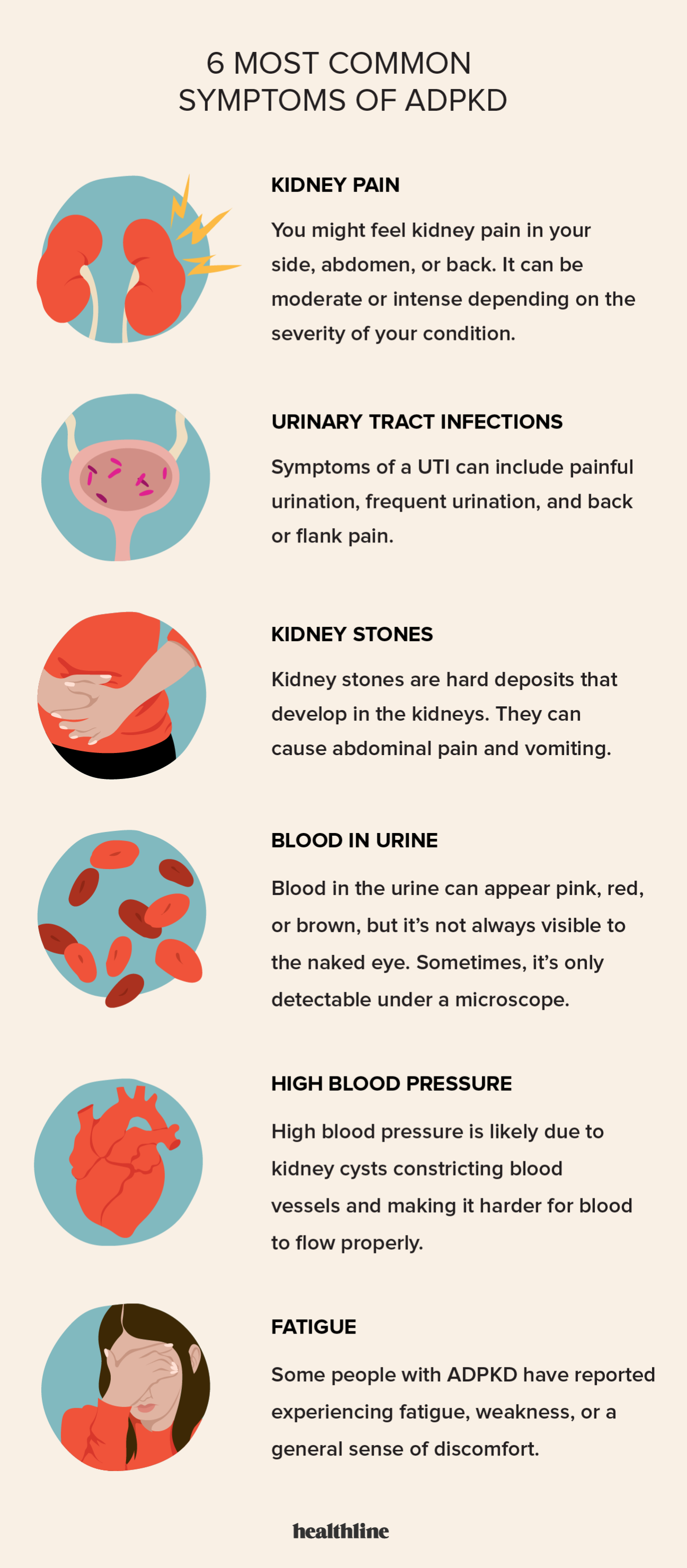 Kidney pain vs. back pain: Location, symptoms, and more