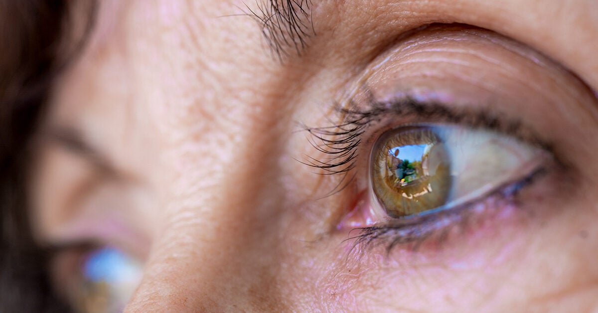Melanoma In The Eye Symptoms Causes Diagnosis Treatment 