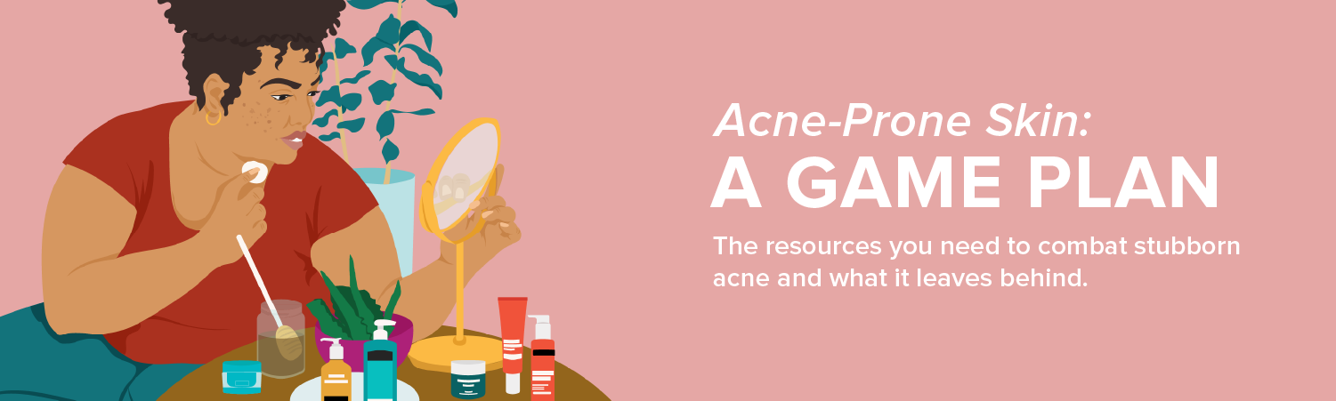 Acne-Prone Skin: A Game Plan