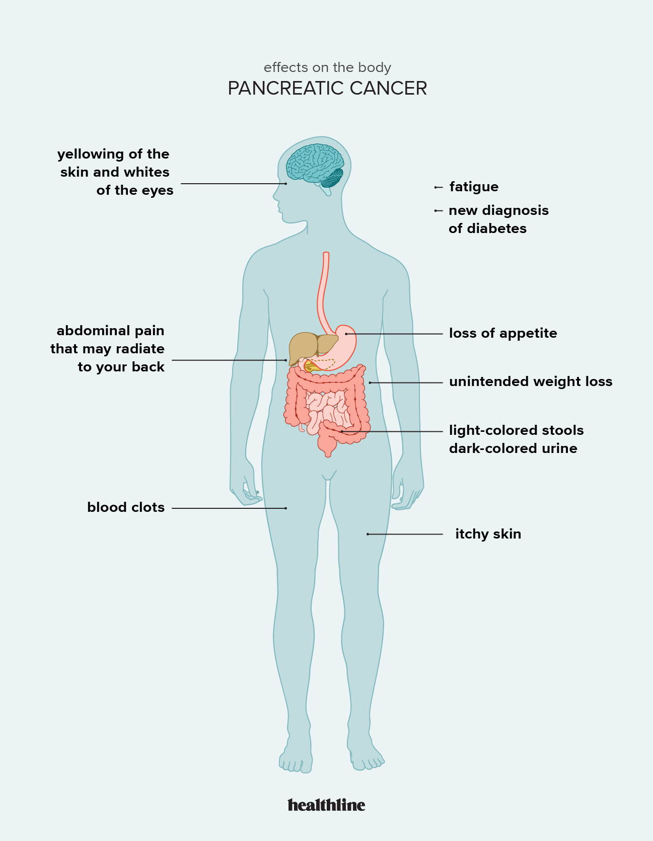 Symptoms Of Pancreatic Cancer