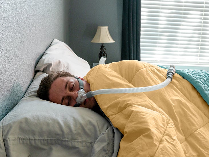 How Sleep Apnea and Weight Gain Contribute to Each Other