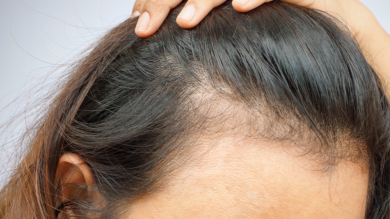 Hair Loss At The Nape Of The Neck: Causes & Treatments | Longevita