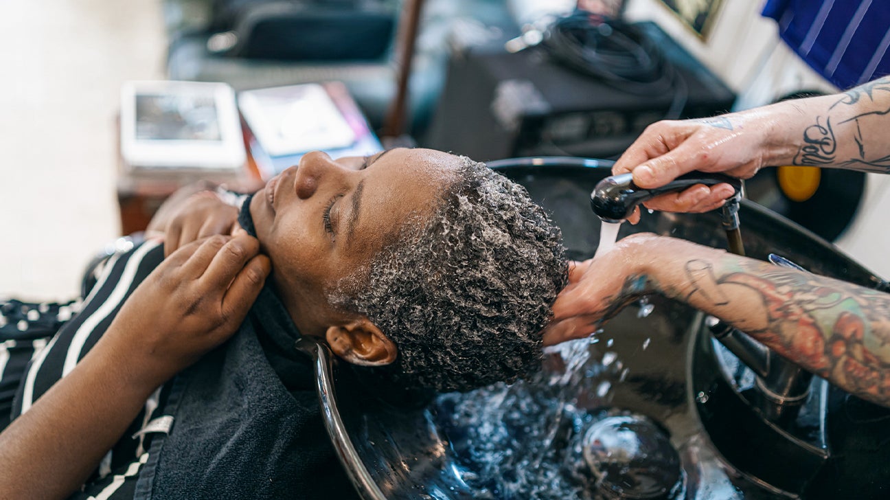 eczema scalp black people
