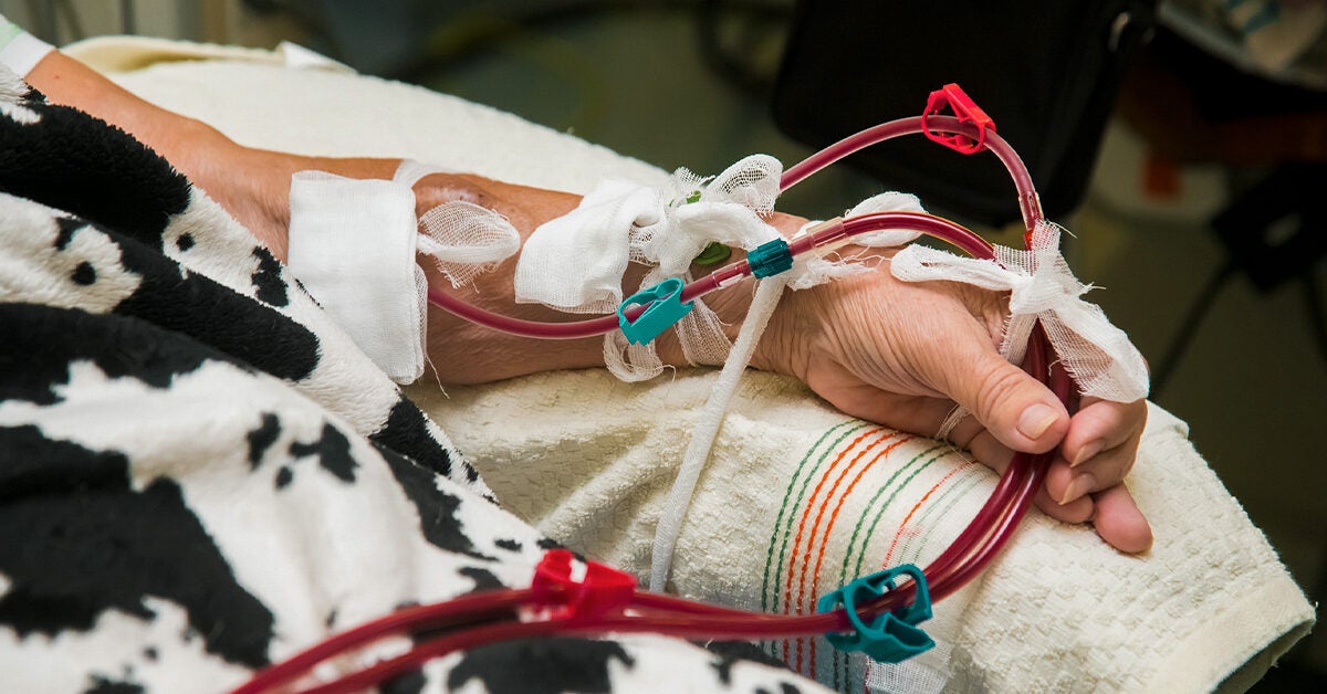 What to Know About Hemodialysis for Advanced CKD