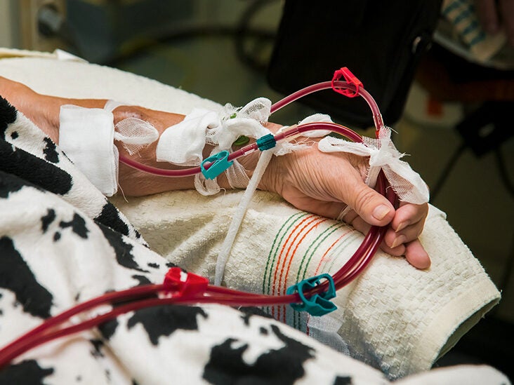Hemodialysis for Advanced Chronic Kidney Disease: What You Need to Know
