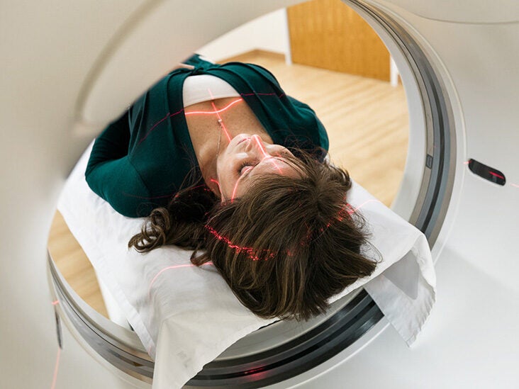 How Accurate Are Low Dose Ct Scans For Lung Cancer Glbnews Com