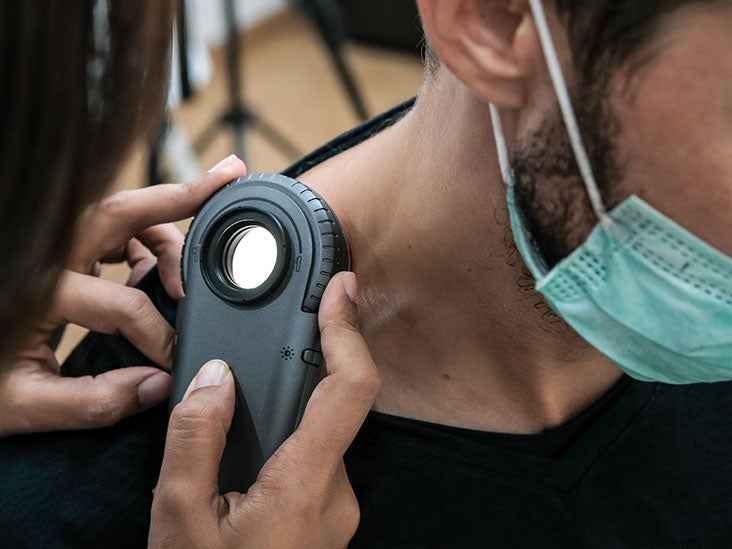 Psoriasis vs. Skin Cancer Pictures, Knowing the Signs, and More