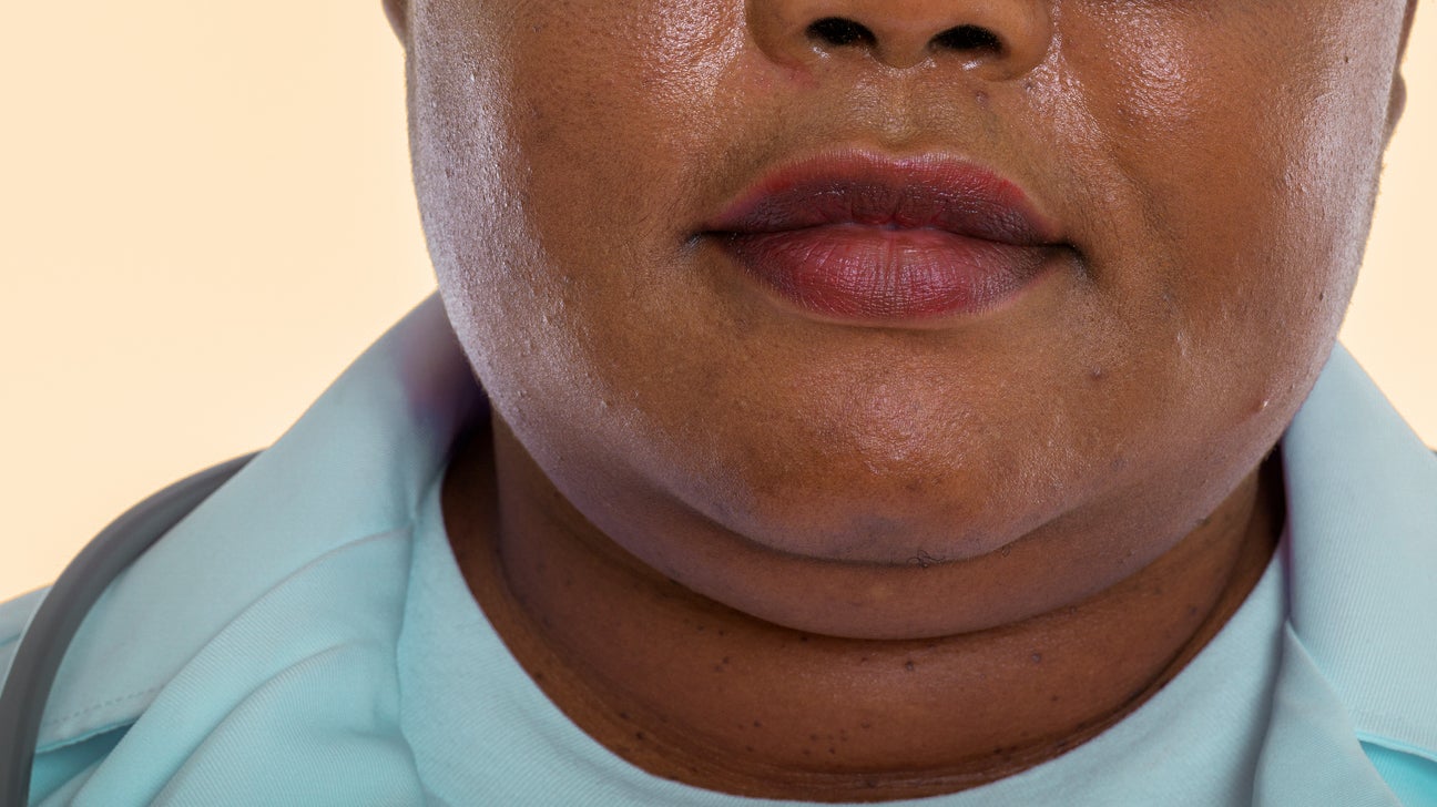 These slimming masks reduce the appearance of a double chin - but