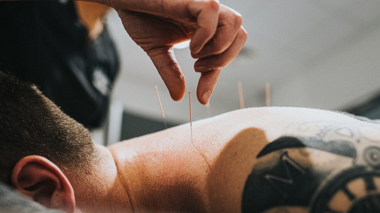 Acupuncture for High Blood Pressure: How It Works