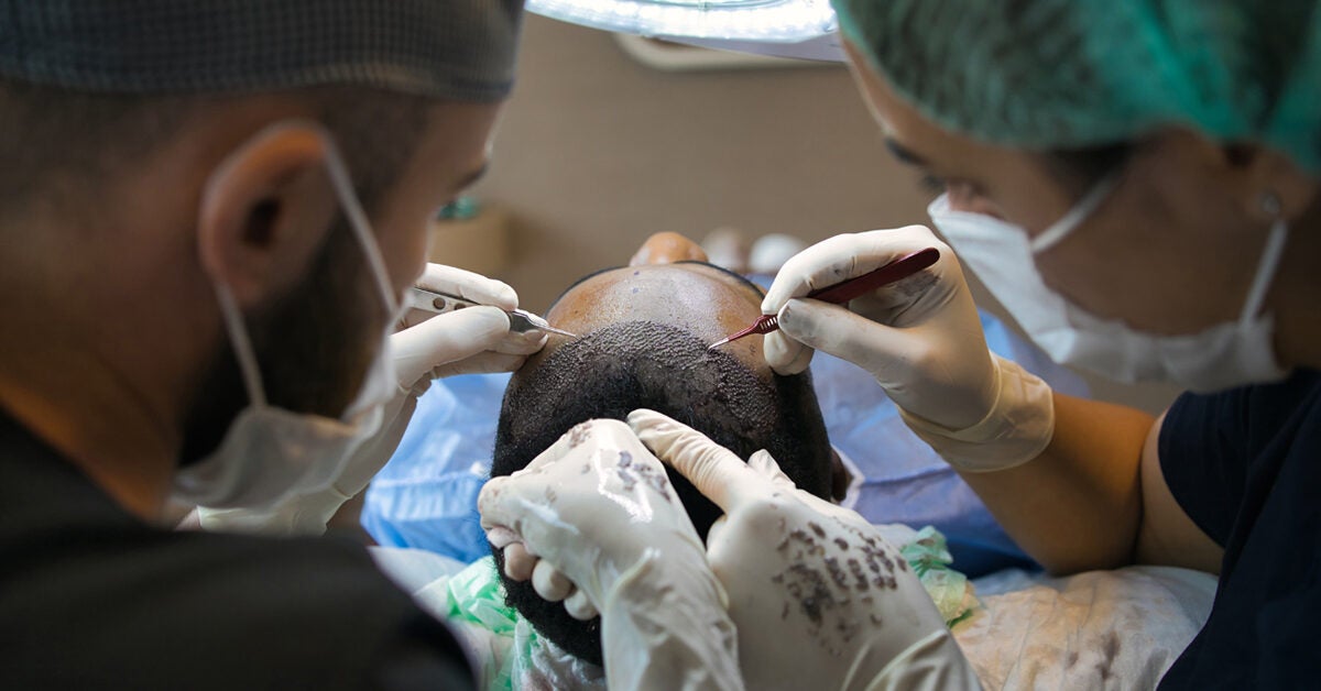 Hair Transplant: Cost of Treatment, Recovery, and More