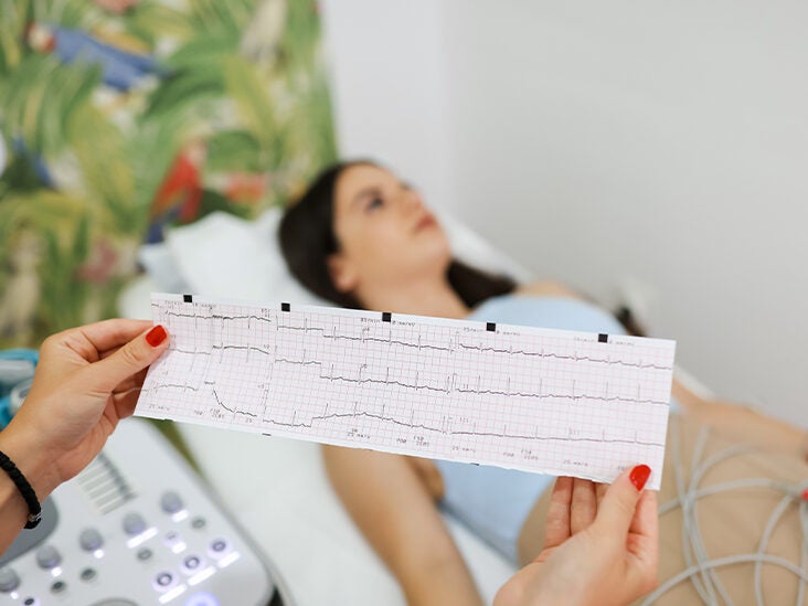 What to Know About Different Types of Arrhythmias