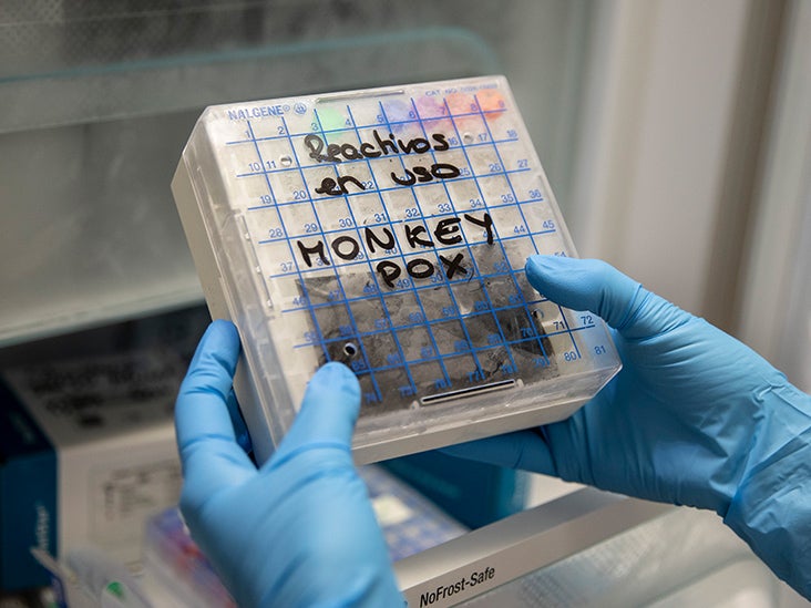 Monkeypox Cases on the Rise What to Know