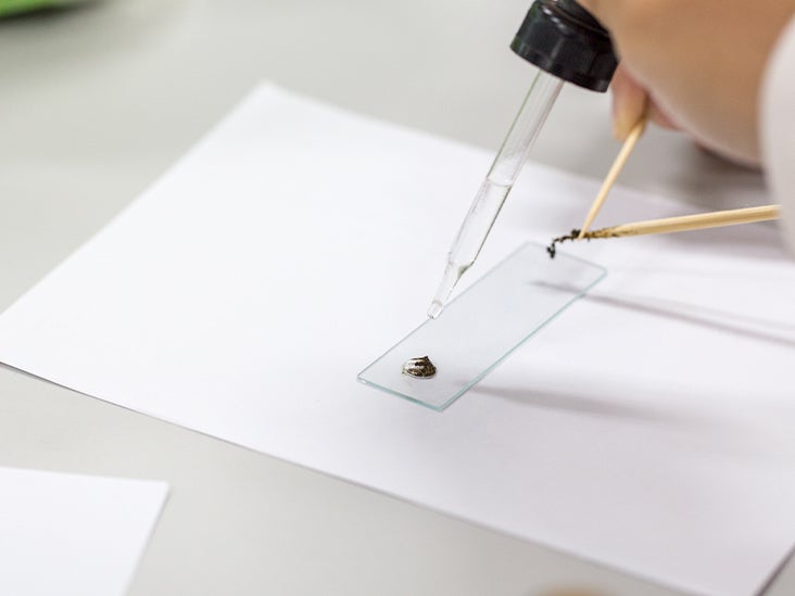 Gastroenteritis and Stool Culture Why It's Needed and How It Helps