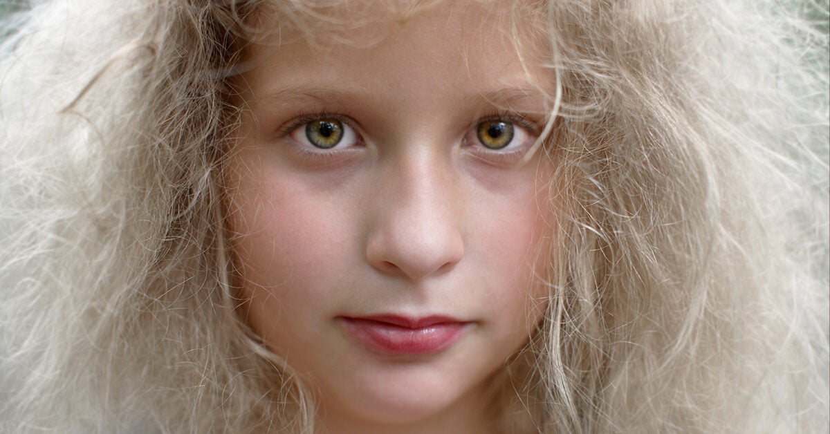 Uncombable Hair Syndrome Is a Rare Genetic Syndrome  and This Little Girl  Has It  Allure