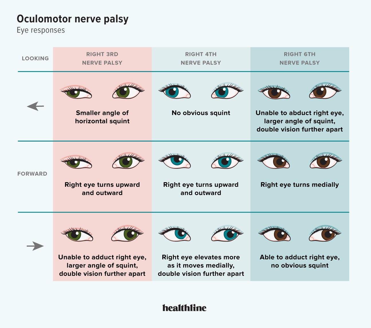 Cranial Nerve 6 Palsy