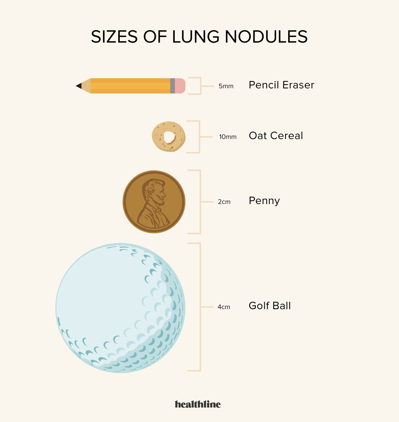 Are Lung Nodules Normal